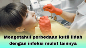 Mengetahui perbedaan kutil lidah dengan infeksi mulut lainnya